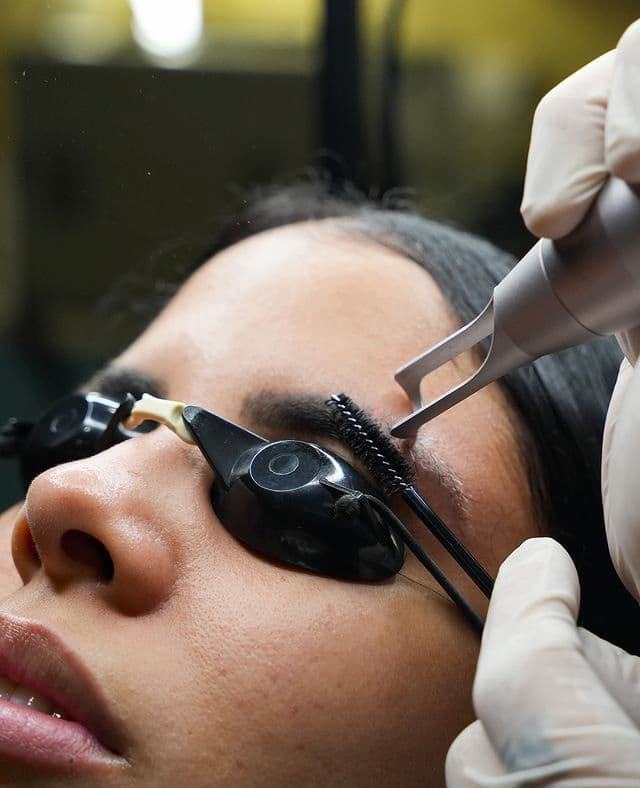 Eliminación de micropigmentación