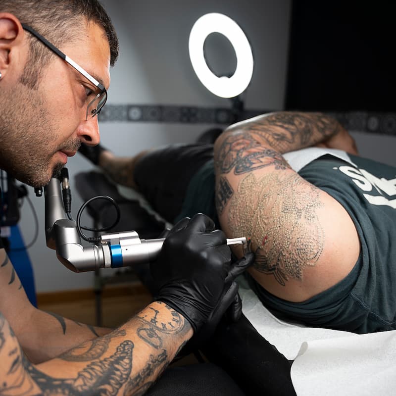 Eliminación de tatuajes en Tattoo Killer