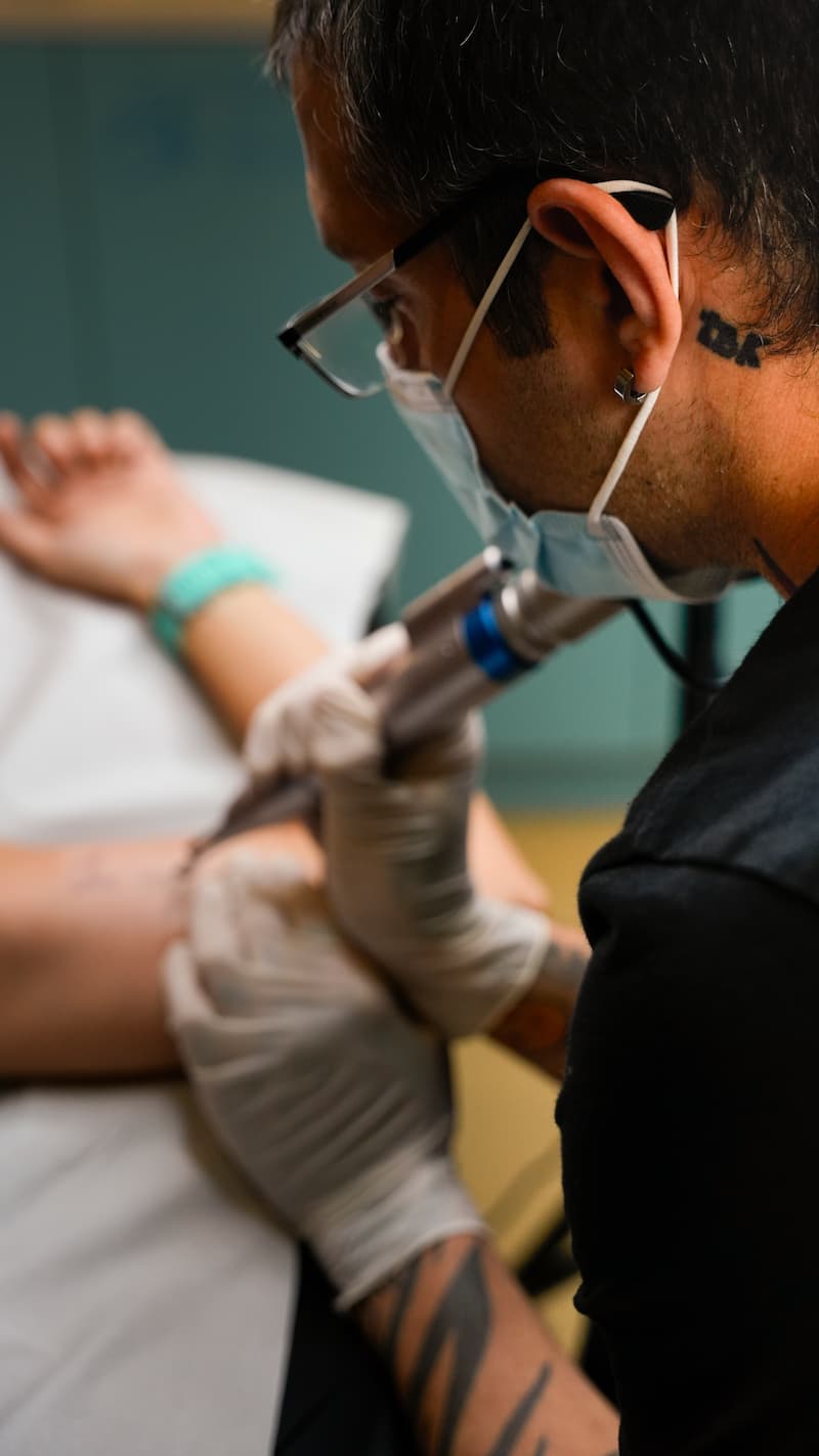 Eliminación de tatuajes en Tattoo Killer